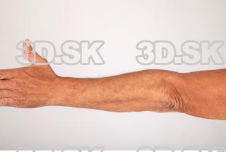 Forearm texture of Augustyn 0001